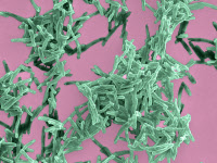 Tuberculous and nontuberculous Mycobacteria