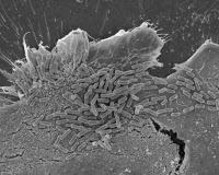 Bactéries Escherichia coli O104:H4 en interaction avec des cellules de l'épithélium intestinal humain 
