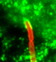Rôle de la clathrine dans l'endocytose de la bactérie Listeria