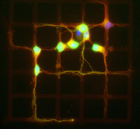 Neurones mis en culture sur des prototypes de micropatterns développés par la société CYTOO.