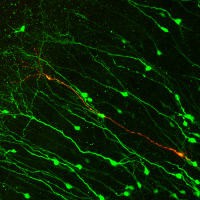Néo-neurones dans un cerveau adulte