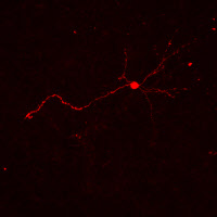Néo-neurone dans un cerveau adulte