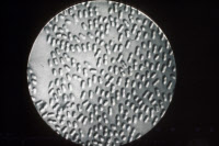 Microphotographie de Mycoderma aceti