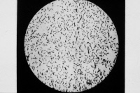 Photomicrographie de bacilles de la tuberculose