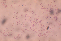 Bordetella pertussis (Bacille de Bordet-Gengou), agent de la coqueluche