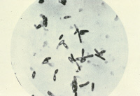 Clostridium butyricum