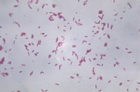 Mycobacterium marinum