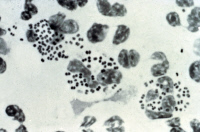 Neisseiria gonorrhoeae dans du pus d'urétrite