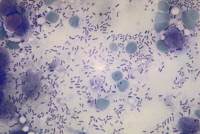 Bacilles de la peste, Yersinia pestis