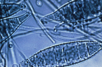 Microsporum canis