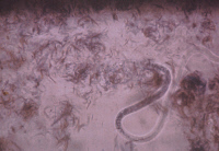 Microfilaire nématode Wuchereria bancrofti