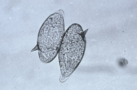 Oeufs de Schistosoma mansoni