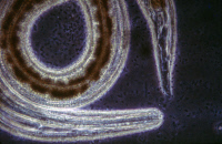 Larve d'Angiostrongylus