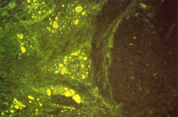 Corps de Negri dans cellules neuronales de chien infectées par le virus de la rage
