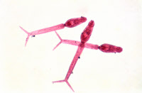 Bilharziose (Schistosomiase)