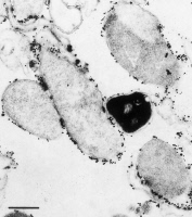 Escherichia coli exprimant un antigène de la poliomyélite