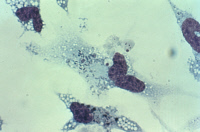 Macrophages ayant phagocyté des salmonella virulentes