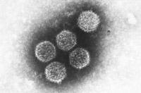 Virus Herpes simplex