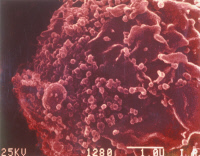 Virus VIH-1 à la surface d'un lymphocyte.