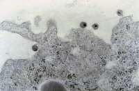 Une des premières photos du virus VIH-1 en 1983