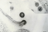 Virus VIH-2