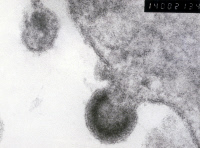 Virus VIH-1 (étape de bourgeonnement à la surface d'un lymphocyte)