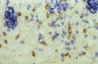 Lésion démyélinisante induite par le virus de Theiler chez une souris