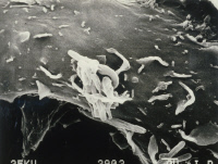 Mycobacterium bovis phagocyté par des macrophages