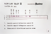 Test de détection du VIH (NEW LAV BLOT II) en 1989