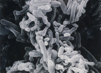 Mycobacterium avium