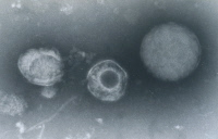 Cytomégalovirus