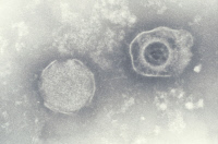 Cytomégalovirus ou Herpesvirus 5 humain (HHV5)
