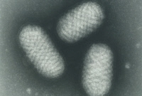 Virus de la vaccine en microscopie électronique