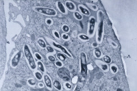 Coupe de macrophage contenant des mycobactéries