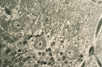 Cellules de Purkinje infectées par le virus fixe de la rage