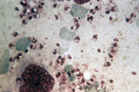 Coupe de rate parasitée par Leishmania donovani