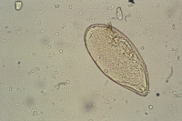 Oeuf de Schistosoma mansoni