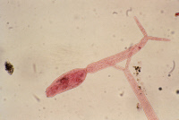 Cercaire de Schistosoma mansoni