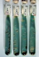 Mycobacterium bovis en culture en 1984