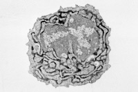 Plasmocyte, lymphocyte B producteur d'anticorps (colorés en noir).