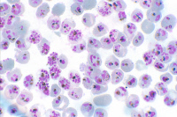 Globules rouges parasités par Plasmodium falciparum