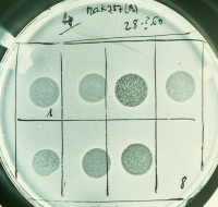 Bactériolyse de Vibrio cholerae par des bactériophages spécifiques