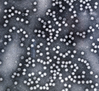 Poliovirus en microscopie électronique à transmission.