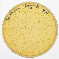 Colonies d'Escherichia coli