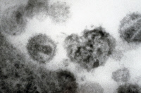 Virus VIH-2