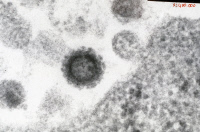 Simian Immunodeficiency Virus ou SIV