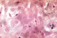 Cellules de rein de chat infectées par un parvovirus