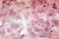 Cellules de rein de chat infectées par un parvovirus