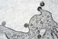 Bourgeonnement de VIH1 à la surface d'une cellule thymique