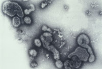 Virus de la grippe type A